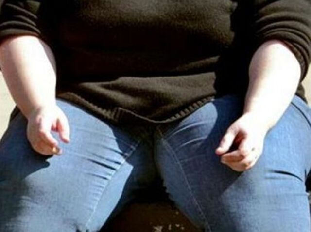Obezita