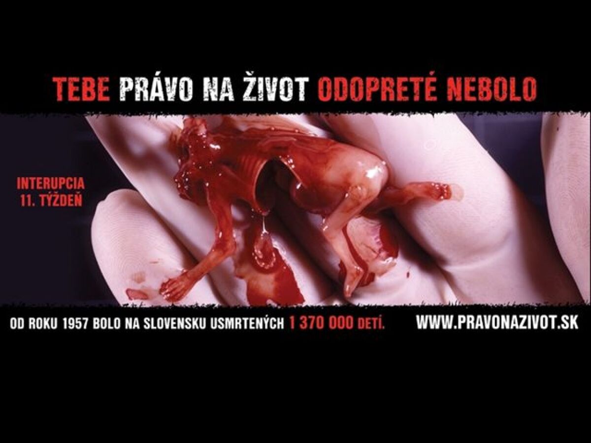 Mŕtvy plod