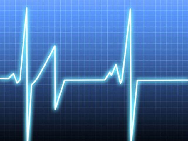 srdce - rytmus - EKG