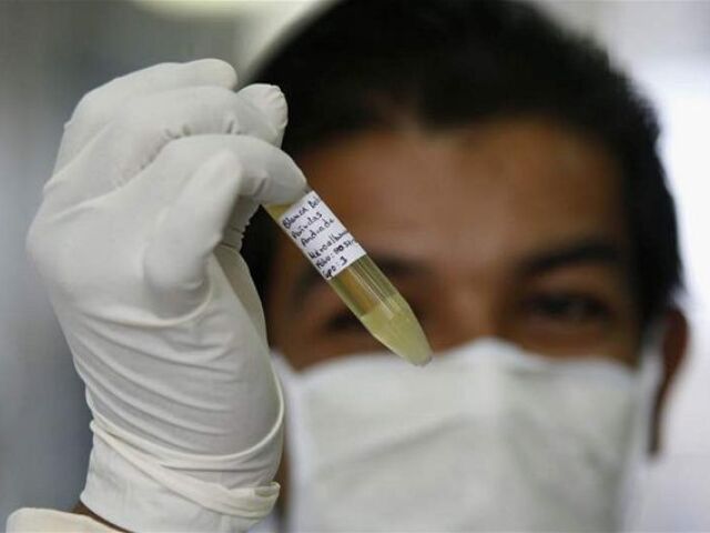 epidemiológ, chrípka, vedec, doktor, vzorka, chrípka, skúmavka