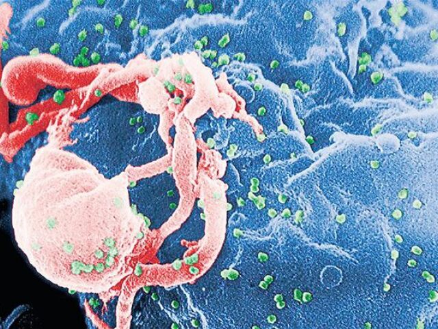 AIDS, HIV