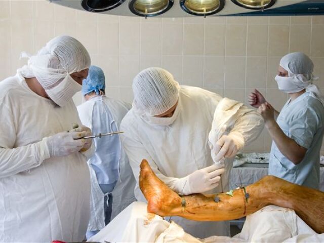 amputácia nohy, lekár, operácia, doktor, nemocnica