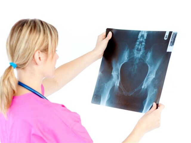 kĺb, bolesť, pohyb, reuma, šport, koleno, rontgen, doktor, lekár, RTG
