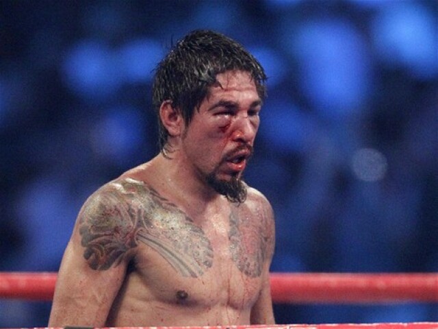 Antonio Margarito