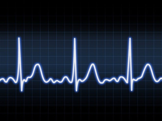 srdce, rytmus, EKG, arytmia, echo, krivka, kardio, infarkt