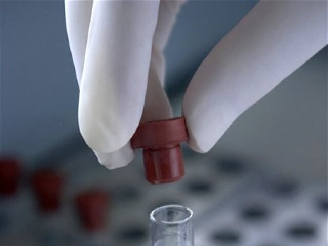 Skúmavka, výskum, laboratórium, test