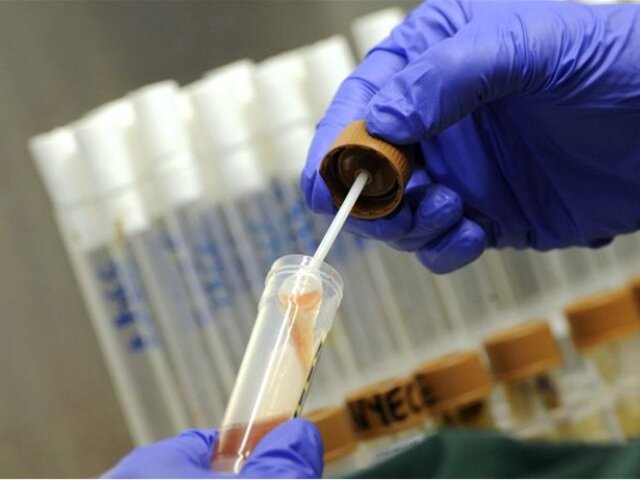 vzorka, baktéria, EHEC, E.coli, laboratórium