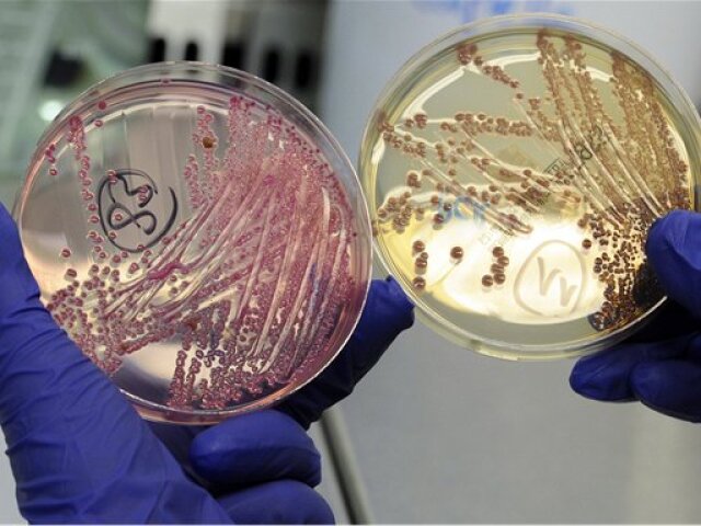 EHEC, baktéria, E.coli