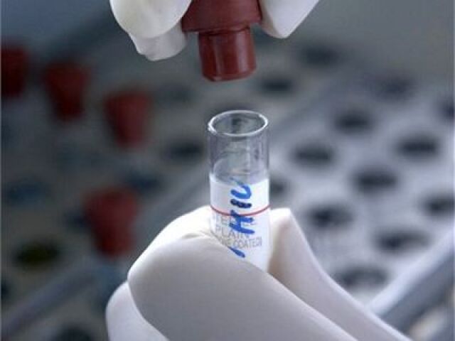 Skúmavka, výskum, laboratórium, test