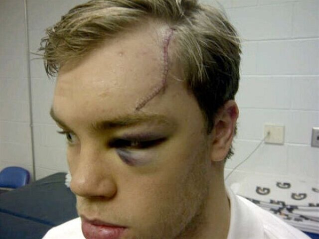 Taylor Hall