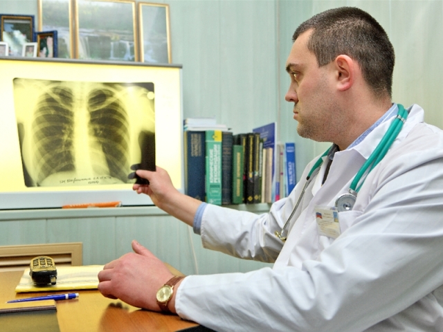 tuberkulóza, pľúca, RTG, doktor, lekár