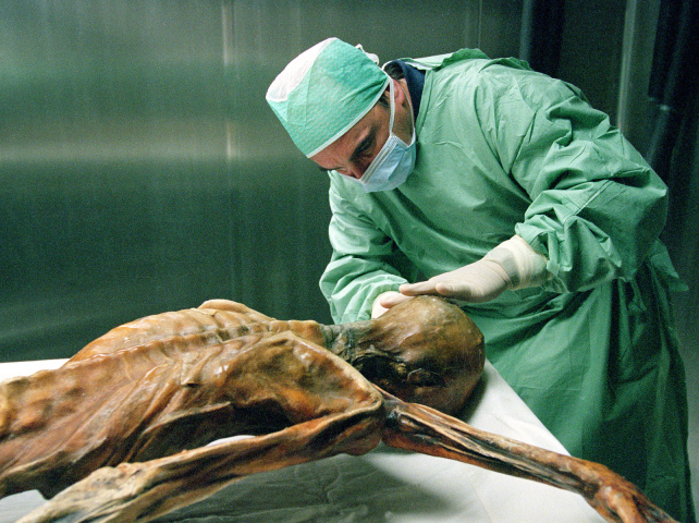otzi