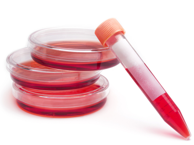 hiv, aids, krv, skúmavka, vyšetrenie