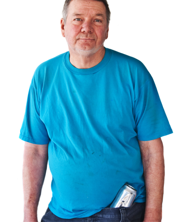 rosacea, začervenanie tváre, ružovka