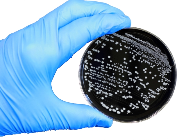 vedec, laboratórium, vyšetrenie, baktérie, hnačka, test