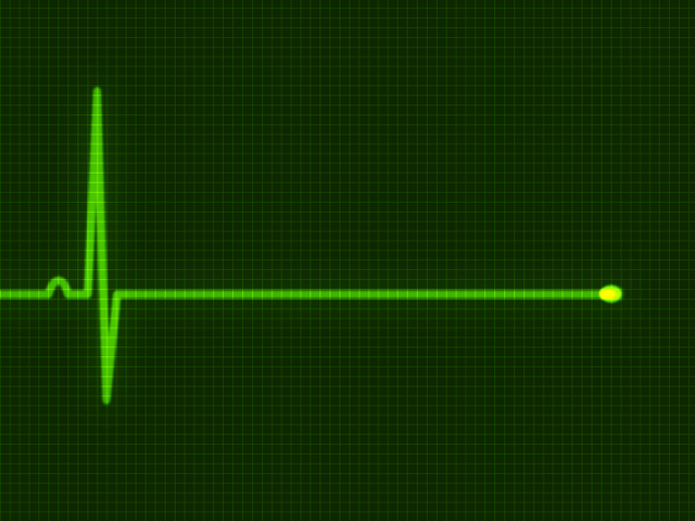 smrť, infakrt, mozog, EKG