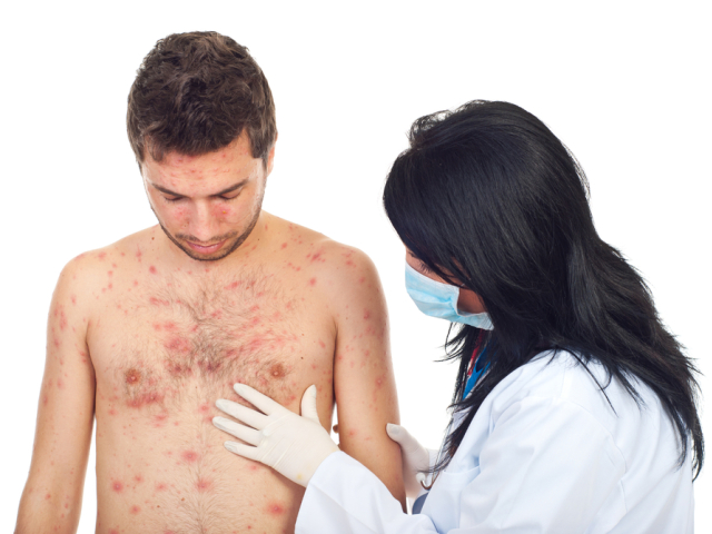 dermatológ, muž u dermatológa