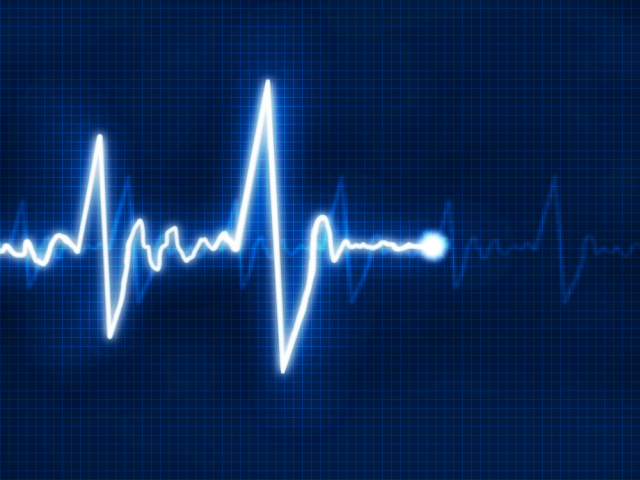 kardiogram, srdce, kardiograf, infarkt, tlkot srdca, tep
