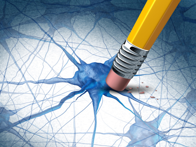 alzheimer, nervy, neurón, mozog