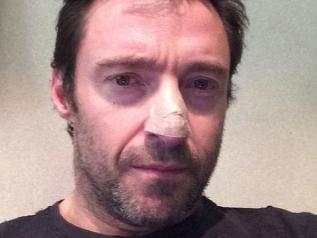 Hugh Jackman 