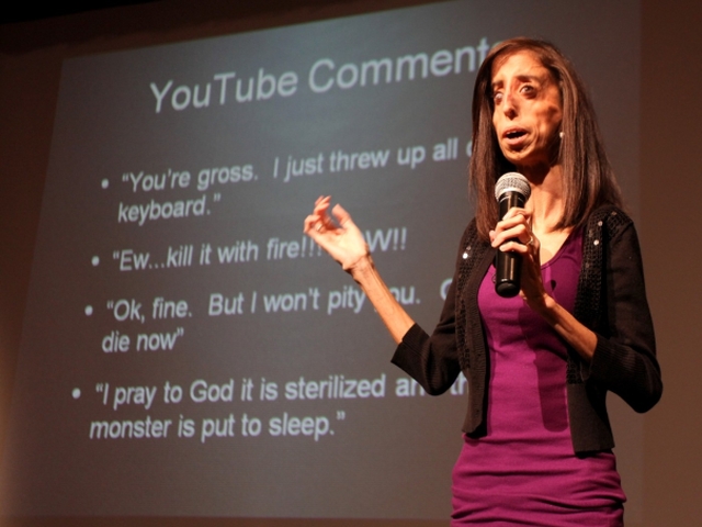 Lizzie Velasquez