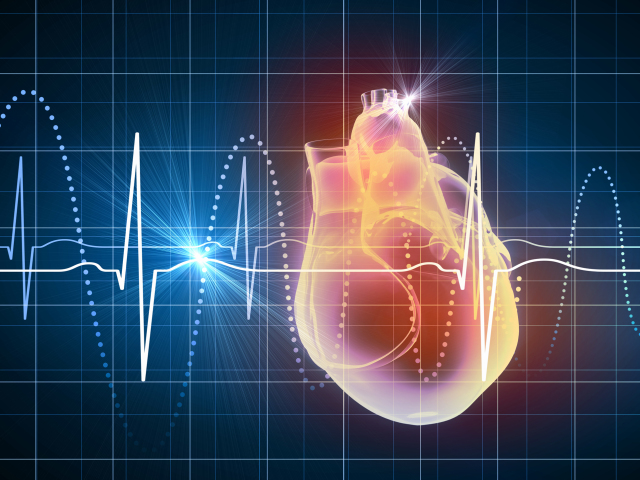 srdce, EKG, tep