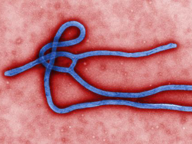 ebola, vírus,