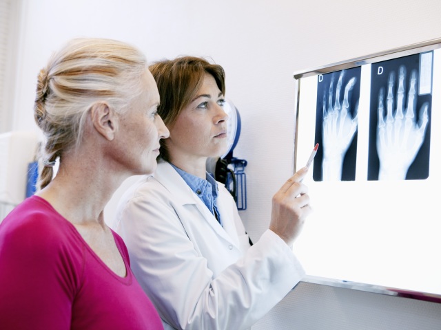 Röntgen, kĺby, vyšetrenie, diagnóza, osteoartróza, lekár, pacient
