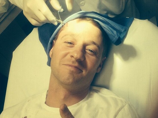 Benjamin McKenzie
