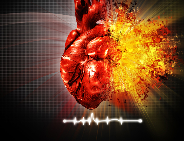 srdce, infarkt, EKG, prvá pomoc, srdcový záchvat, nemocnica