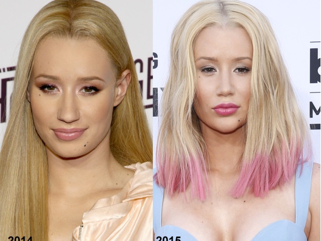 Iggy Azalea