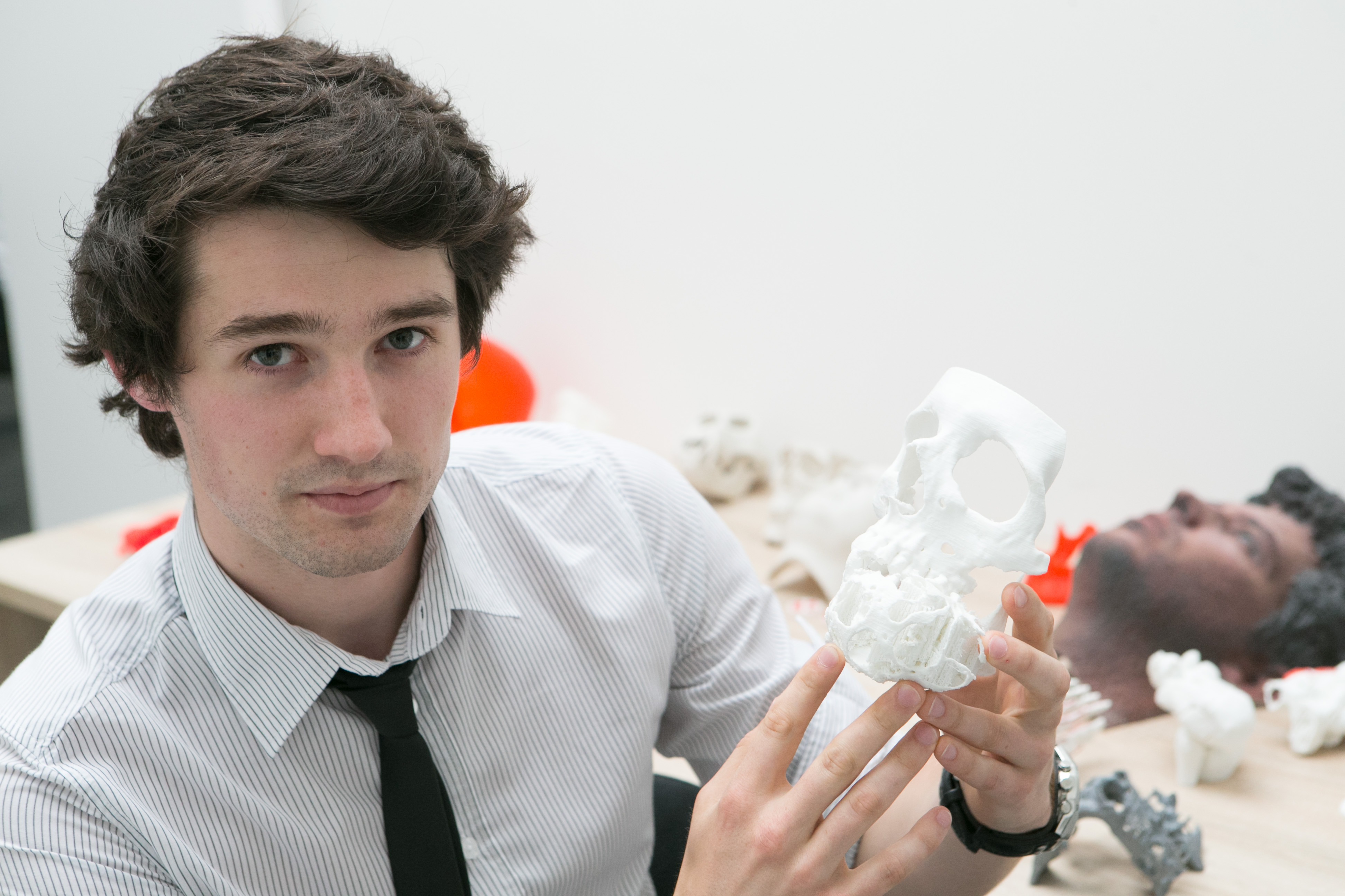 Tomáš Havran ukazuje na model lebky s nádorom na čeľusti.