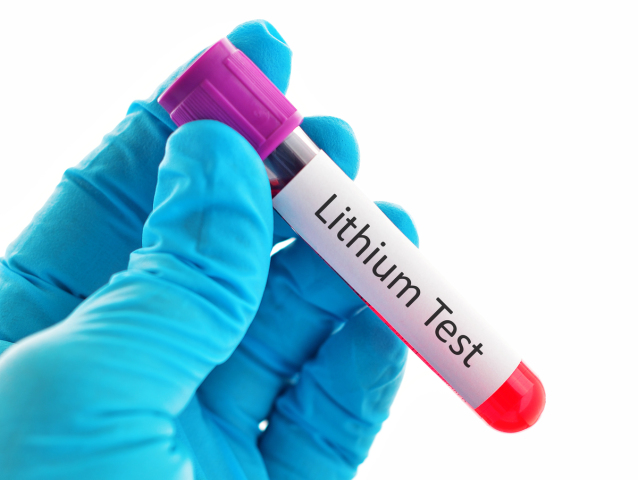 lítium, lithium, skúmavka, vedec, výskum, test, veda