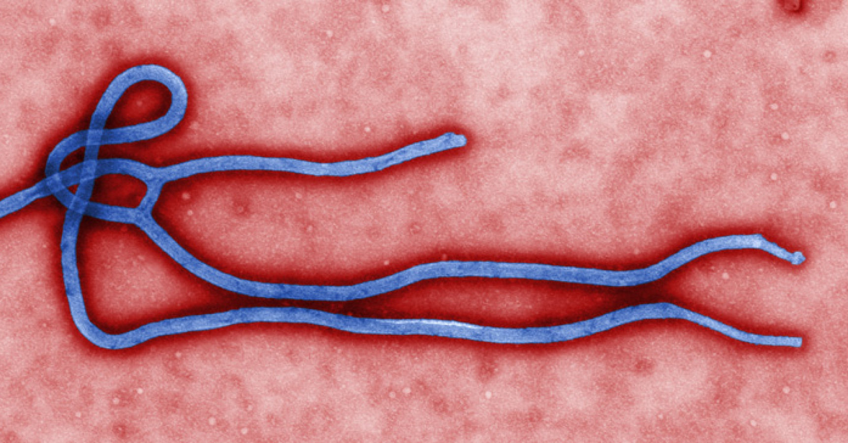 ebola, mikroskop, vírus