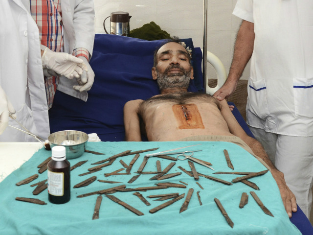 India, pacient, nože, operácia