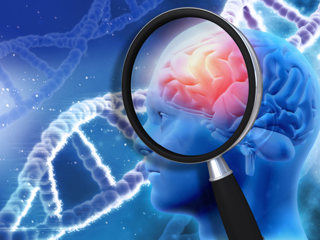 alzheimerova choroba, pamat, demencia, mozog