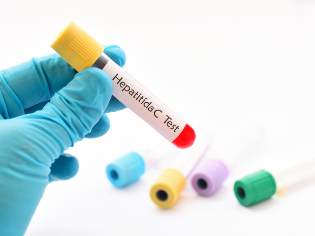 hepatitída, test, krv
