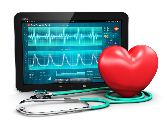 srdce, monitor, rytmus srdca, arytmia