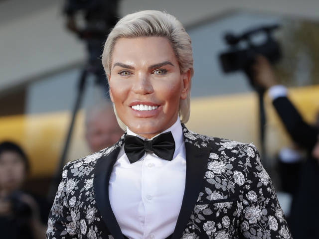 Rodrigo Alves a jeho plastikami zmenená tvár. 