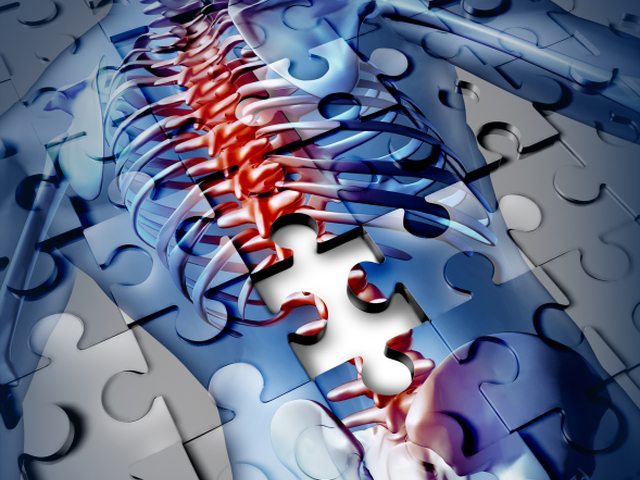 osteoporóza, chrbtica, kosti,