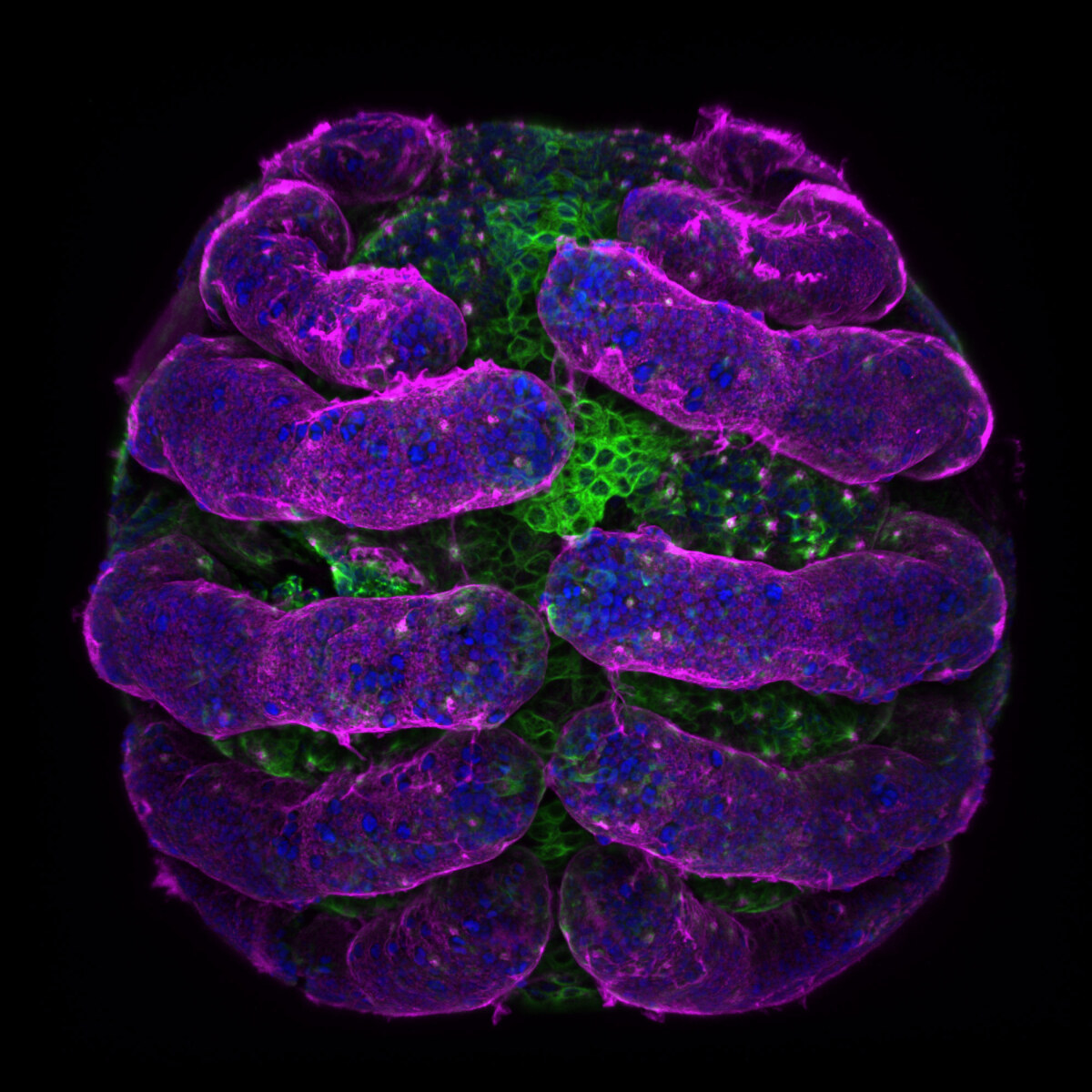 spider embryo