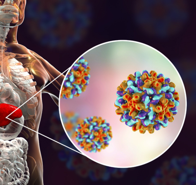 hepatitída typu B, baktérie, vírus, zdravie