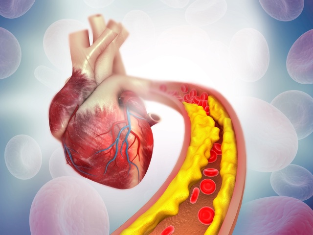 srdce, cholesterol
