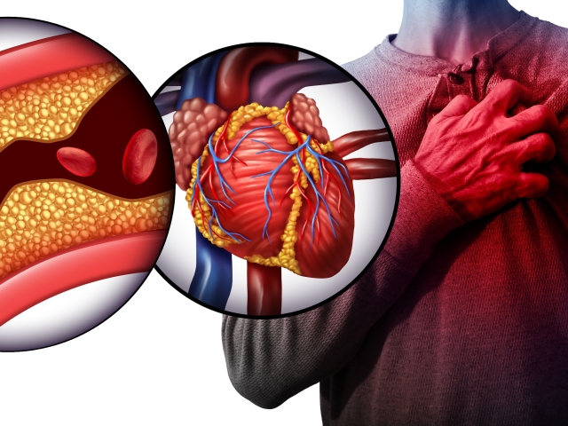srdce, cieva, cholesterol, krv, infarkt