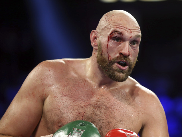 Tyson Fury