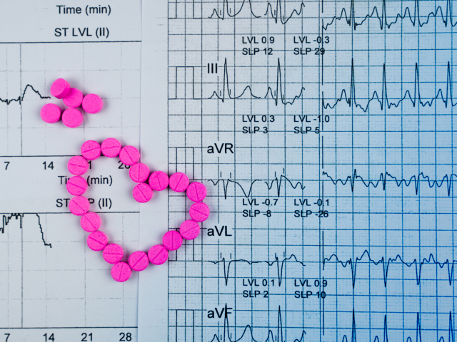 srdce, fibrilácia, EKG