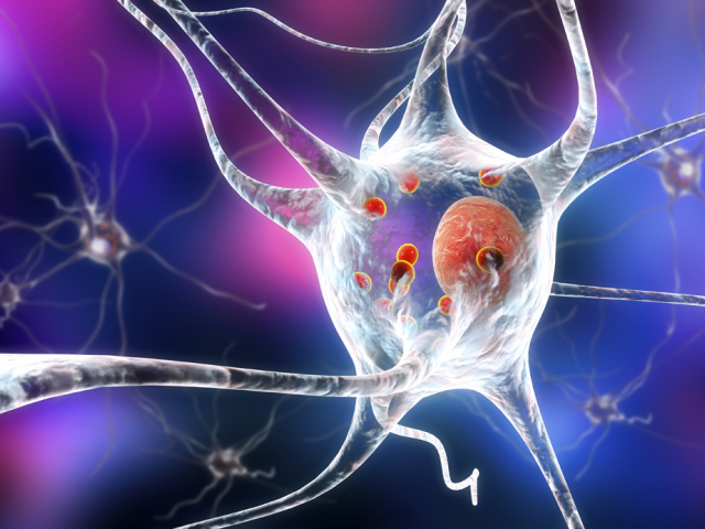 neurón, Parkinson