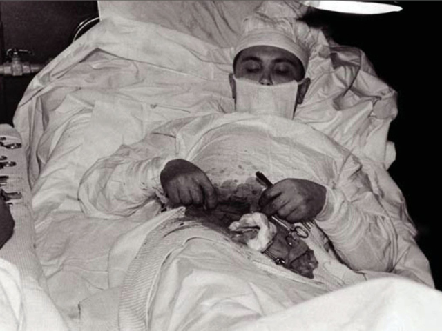 Leonid Rohozov, samooperácia, slepé črevo, doktor