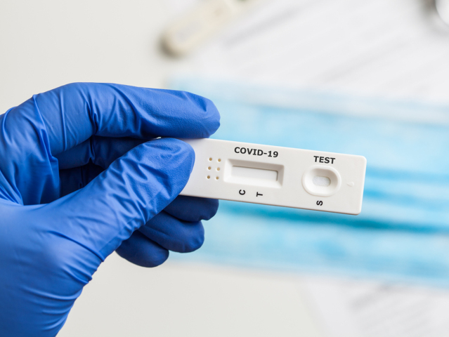 Covid-19, test, antibody test, protilátkový test