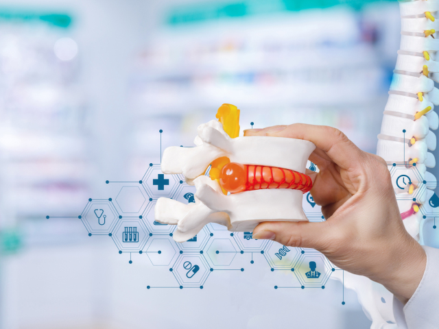 chrbtica, stavce, stavec, osteoporóza